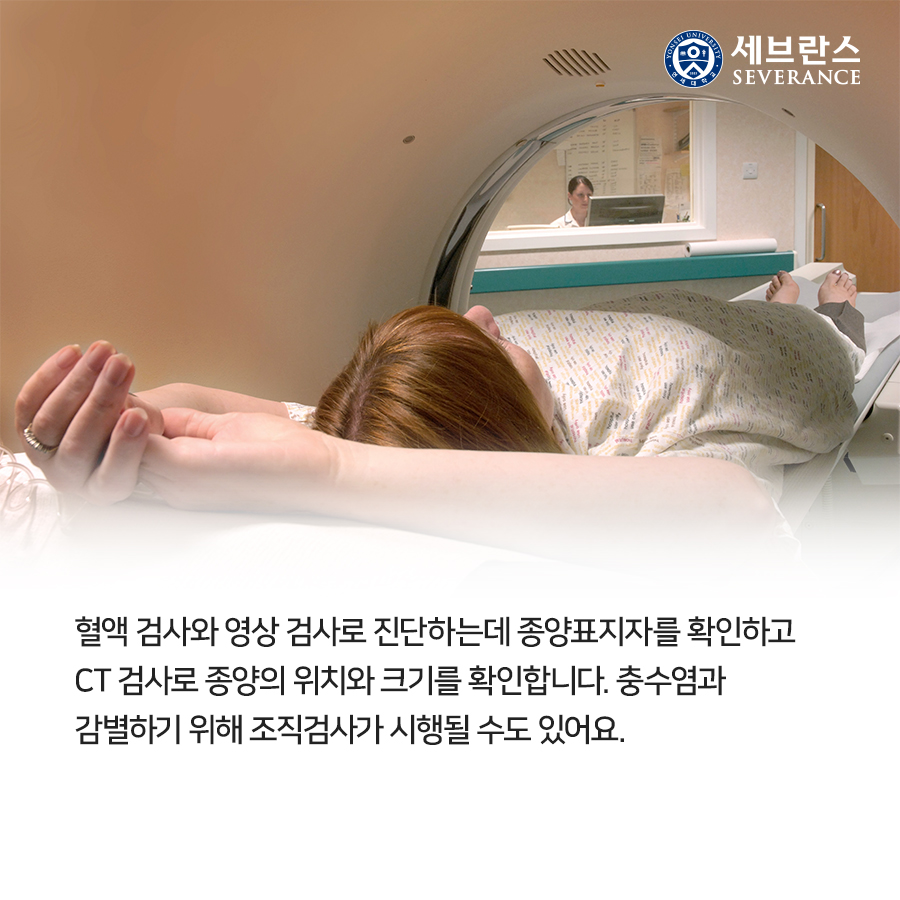 혈액 검사와 영상 검사로 진단하는데 종양표지자를 확인하고  CT 검사로 종양의 위치와 크기를 확인합니다. 충수염과  감별하기 위해 조직검사가 시행될 수도 있어요.